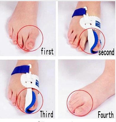 Toe Correction Night Foot Care Orthotics - ValasMall
