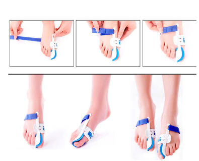 Toe Correction Night Foot Care Orthotics - ValasMall
