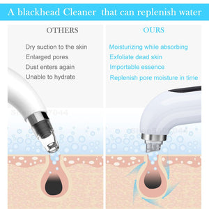 white head remover  vacuum pore cleaner  pore vacuums  pore cleaner tool  Pore cleaner  pimple remover machine  nose blackhead remover  blackhead vacuums  Blackhead sucker  blackhead remover tool  blackhead remover mask  blackhead remover machine  blackhead remover cream  blackhead remover  blackhead extraction tool  blackhead extraction  best blackhead vacuum  best blackhead remover tool  best blackhead remover for nose  best blackhead remover
